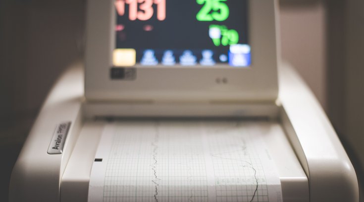 ECG Stock Image