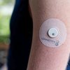 Type 1 Diabetes Increase