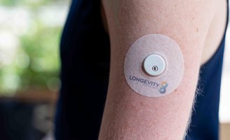 Type 1 Diabetes Increase