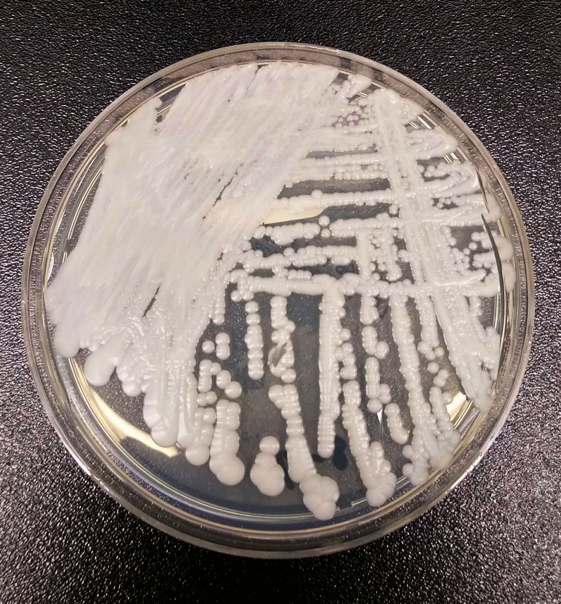 Drug-resistant fungal infections are increasing in Philly health care facilities — just as they are nationwide