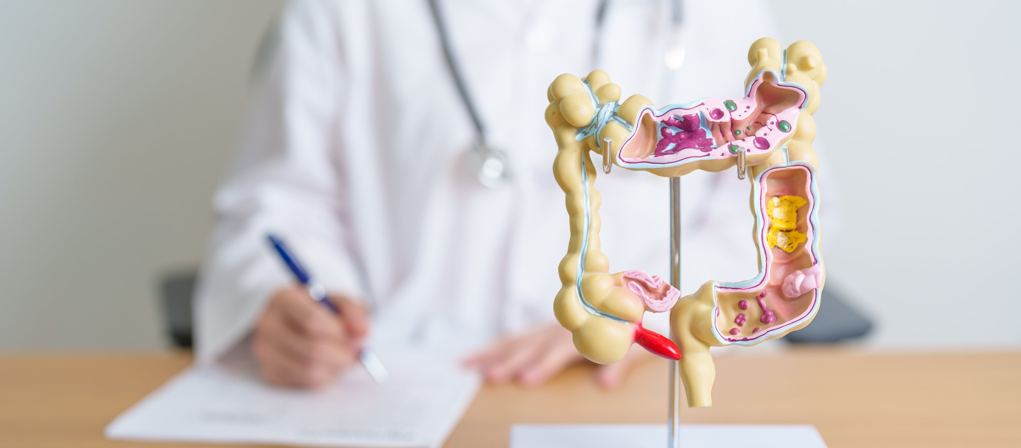Colorectal cancer screening guidelines now include new stool and blood tests